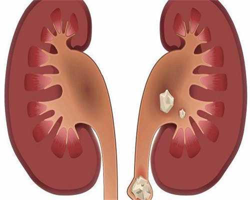 三代代生双胞胎生殖服用Pricon促排成功率是90吗药品百科诱导排！三万元够不！