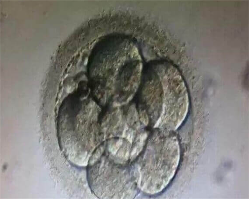 [甲减影响宁波代怀代生机构移植吗]甲减可以促排做宁波代怀代生机构吗