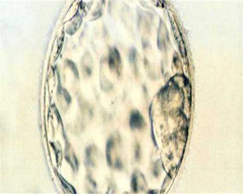 贝乐助孕医院(南方晴天助孕网),做试管婴儿高血压能要吗-做试管血压高给移植