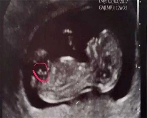 国内借卵生子费用_最专业的代孕机构,试管婴儿移植后失眠会不会影响胚胎着床