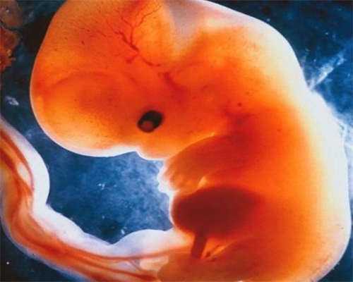 35万包生儿子_包成功代生,试管移植怀孕后第一天可以吃百香果吗？