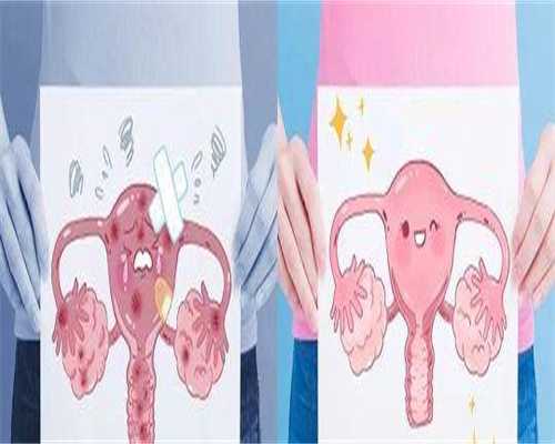 卵泡较大影响做试管吗孕妇 卵泡较大影响做试管吗孕妇怎么办