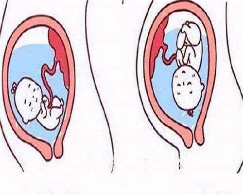 包生男孩多少钱_代生子包成功,做了宫外孕清宫手术后能做试管婴儿怀孕吗？