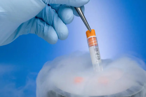 做试管前需要检查造影吗？做试管前需要检查造影吗？