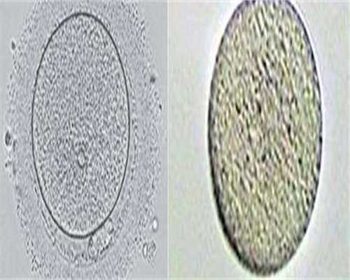 借卵生子包生男孩_包成功代怀网,amh0.24别以为没生育的可能！科学调理自然怀孕