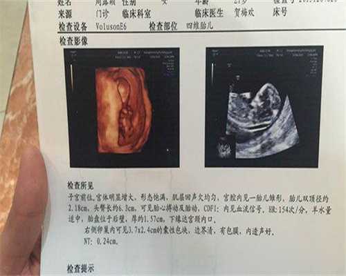 国内首位家代生男孩好吗医院是哪家_国内首位个代生男孩好吗