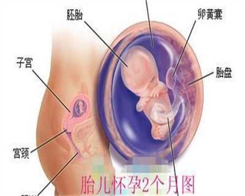 试管代孕应该怎么选择,多囊卵巢可不可以自然受孕？