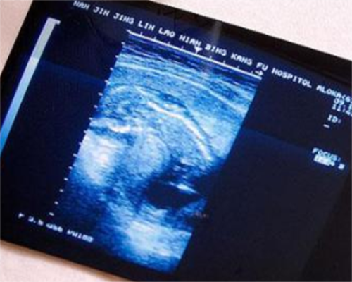 广西三代佛山代生女医院有几家？这家佛山代生女技术好不好