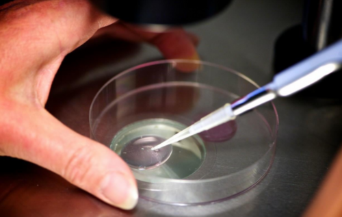 供卵包男孩-女性做输卵管复通术后的护理方法