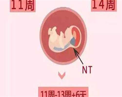 代孕公司机构哪家好,什么人容易得多囊卵巢为什么会出现多囊卵巢