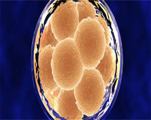 引起卵巢早衰的原因