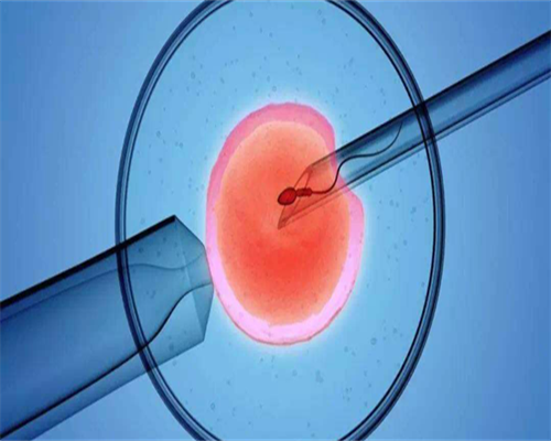 哪家代孕信誉最好,[精子库如何取精]精子库是怎么取精的