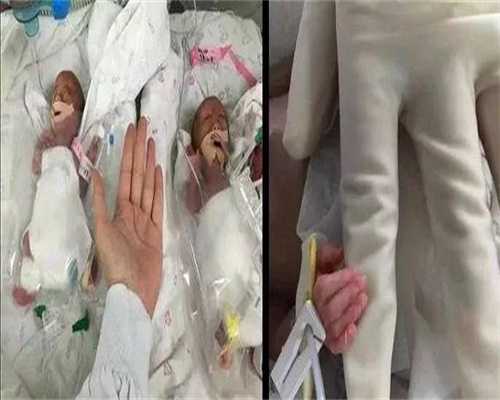 2026年浙江比较好的三代试管医院是哪一家