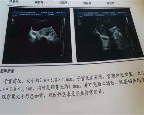 陕西三代代生哪家正规能成功吗，附代生哪家正规流程费用！