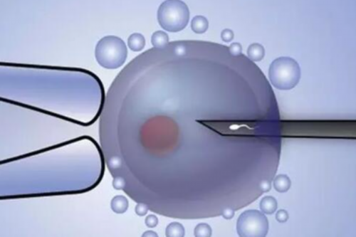 佛山57岁做三代试管做一次大约多少钱？大约七万到十五万！