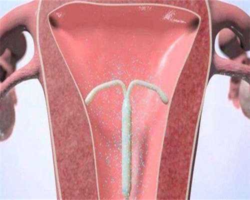 试管婴儿排卵期孕酮值