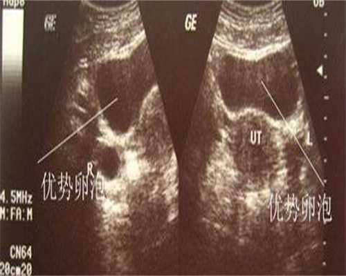 代生包生男孩吗_代生费用包生,
              备孕吃坤育宝虾青素复合片有助于怀