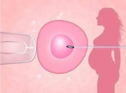 金华人民医院代生儿子收费费用详解(代生儿子收费移植冻胚检查项目)